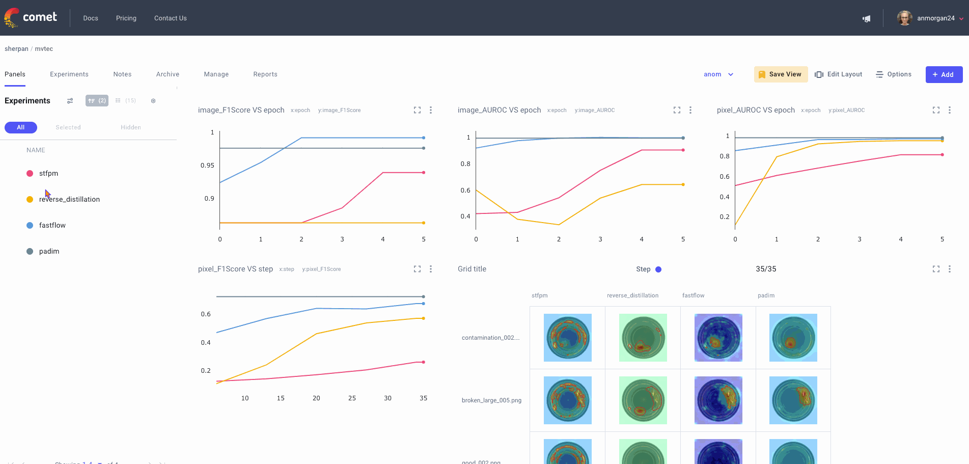 screenshot of Comet platform, showing panels computer vision